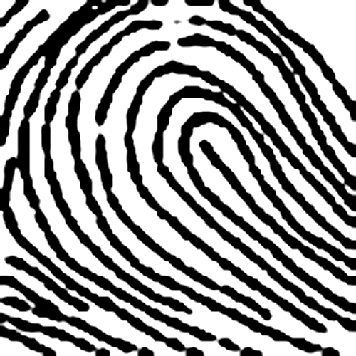 Chủng nước xuôi (Ulnar Loop)