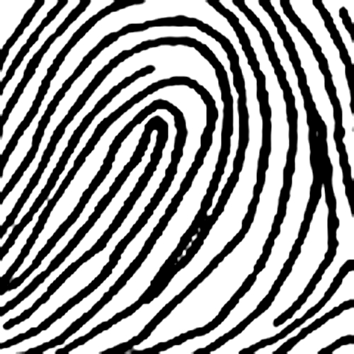 Chủng nước ngược (Radial Loop)